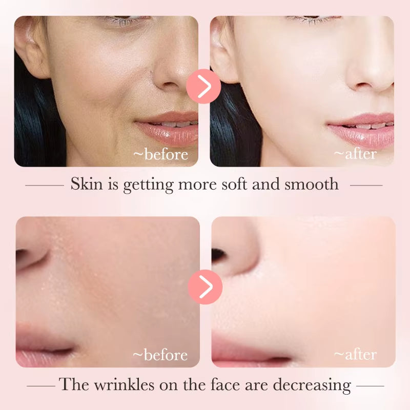 Silanda Beauty Bioaqua Nicotinamide Serum Korean Skincare Dispelling Freckle Face Essence Skin Whitening Facial Serum 30Ml