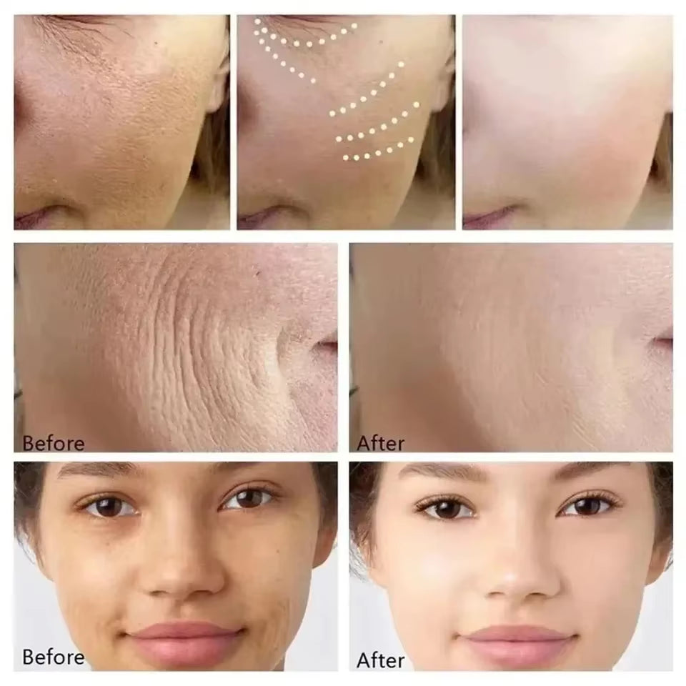 Retinol Wrinkle Removal Facial Kit Instant Firming Enhancement anti Aging Serum Fading Fine Line Whitening Korean Skincare