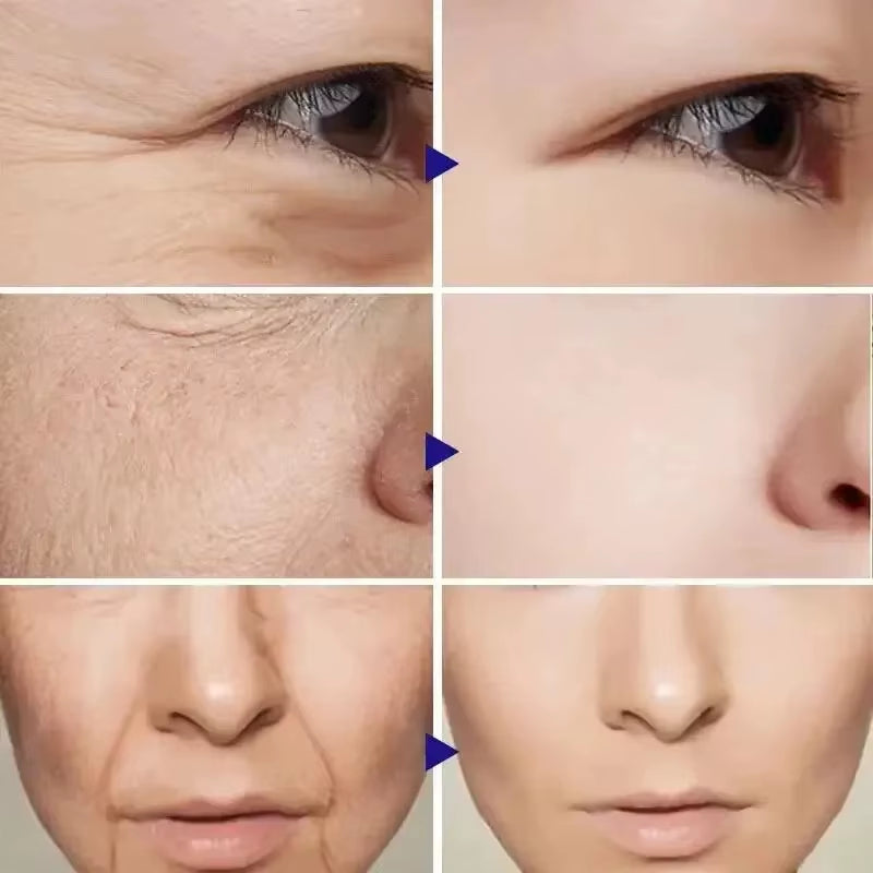 Retinol Wrinkle Removal Facial Kit Instant Firming Enhancement anti Aging Serum Fading Fine Line Whitening Korean Skincare