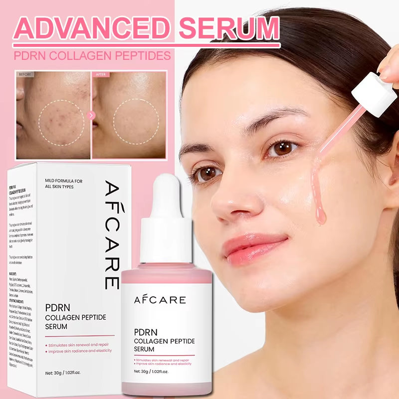 Complex Peptide Acne Serum PDRN Collagen Shrink Pores Fade Melanin Smooth Brightening Skin Korean Skincare Products
