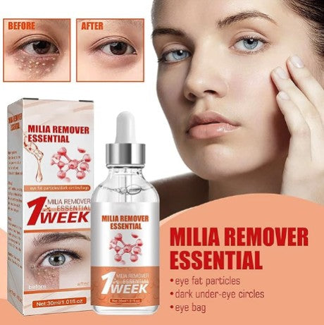 Smooth Milia Remover Serum