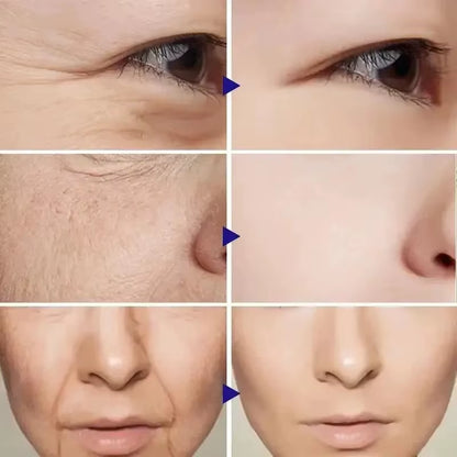 Retinol Wrinkle Removal Facial Kit Instant Firming Enhancement anti Aging Serum Fading Fine Line Whitening Korean Skincare